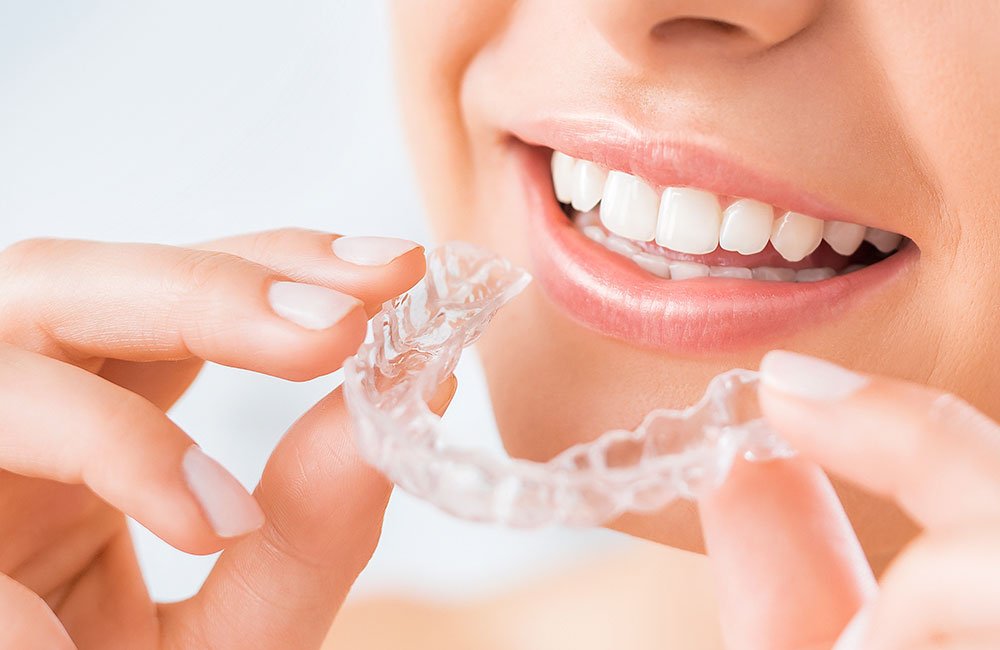 Invisalign - Dentist in Diamond Bar CA