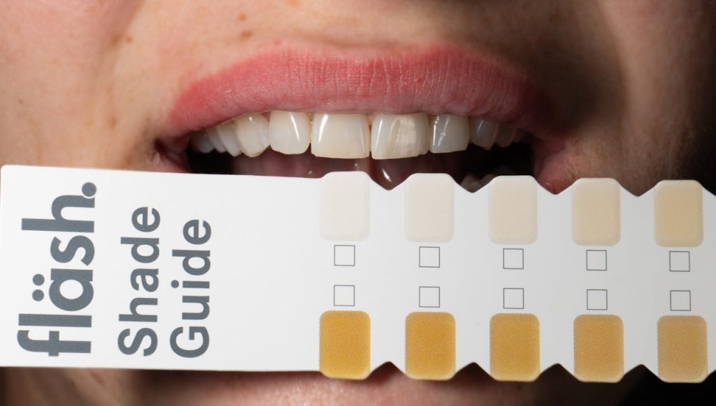 tooth colored restorations