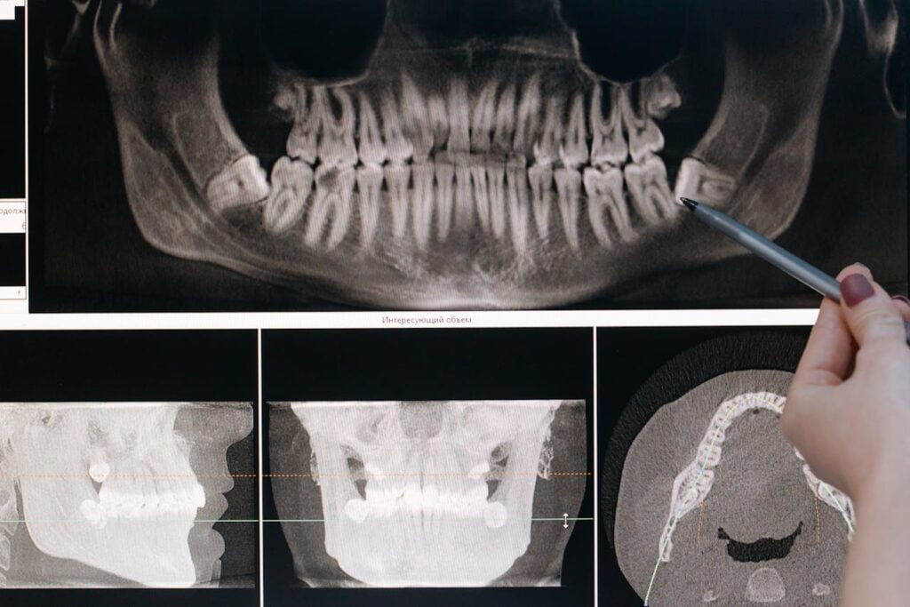 Dental X-rays