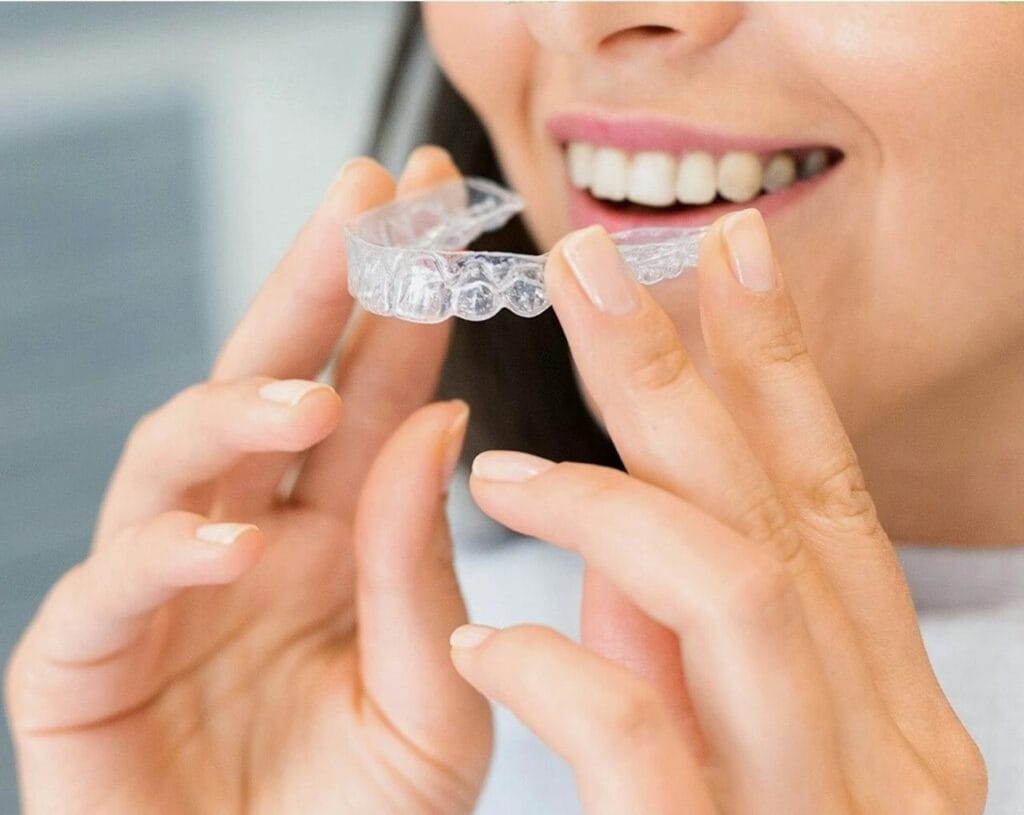 Clear Aligners