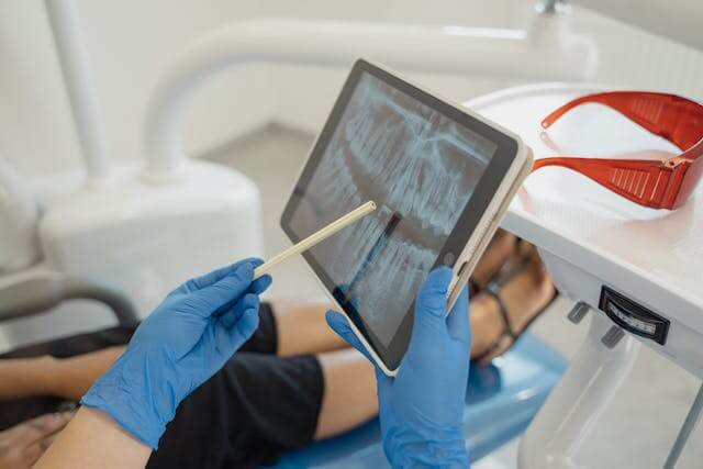 root canal