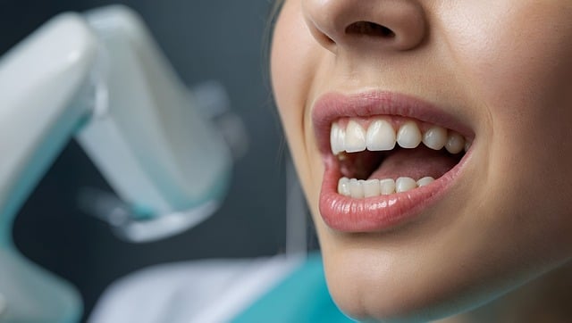 root canal
