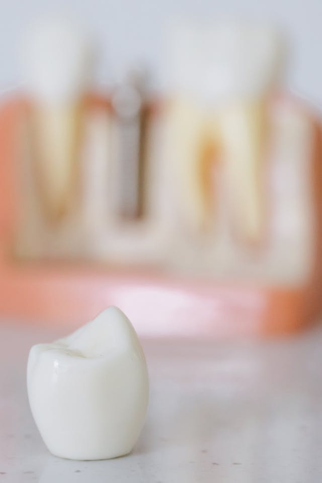 dental crowns