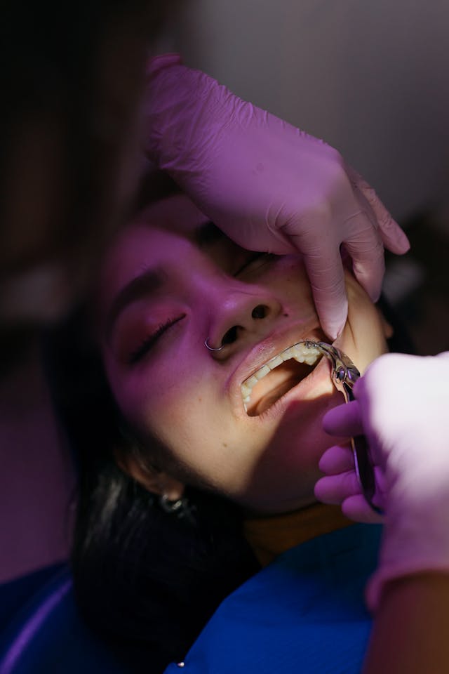 tooth extraction