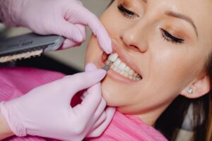 smile makeover
