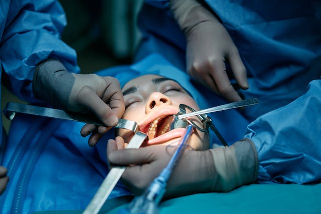 oral surgery