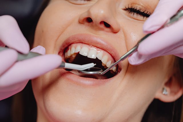 dental cleaning
