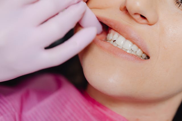 dental cleaning