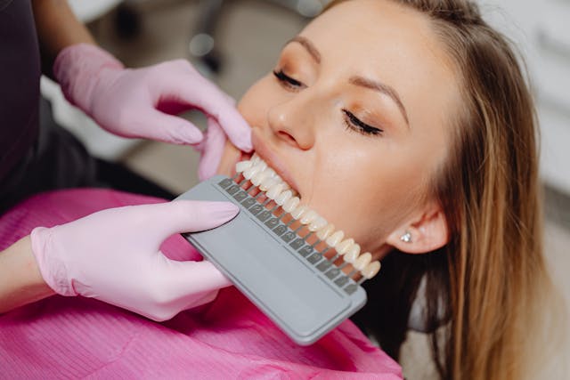 veneers