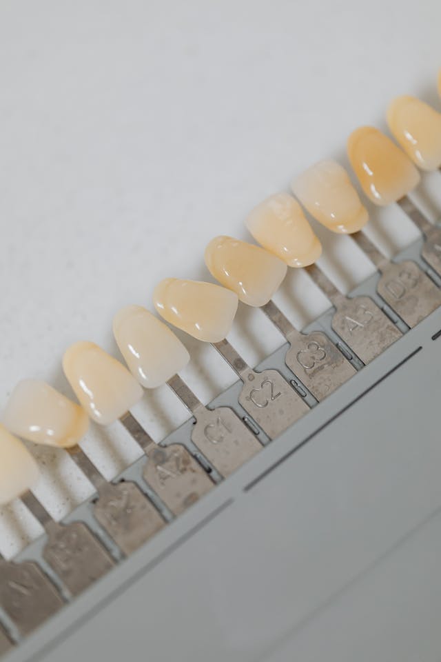 veneers