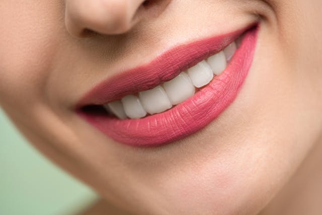 dental implants