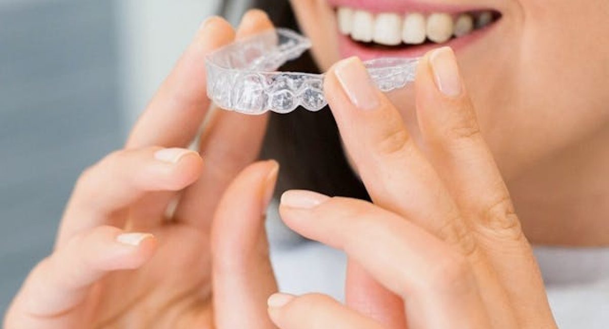 invisalign