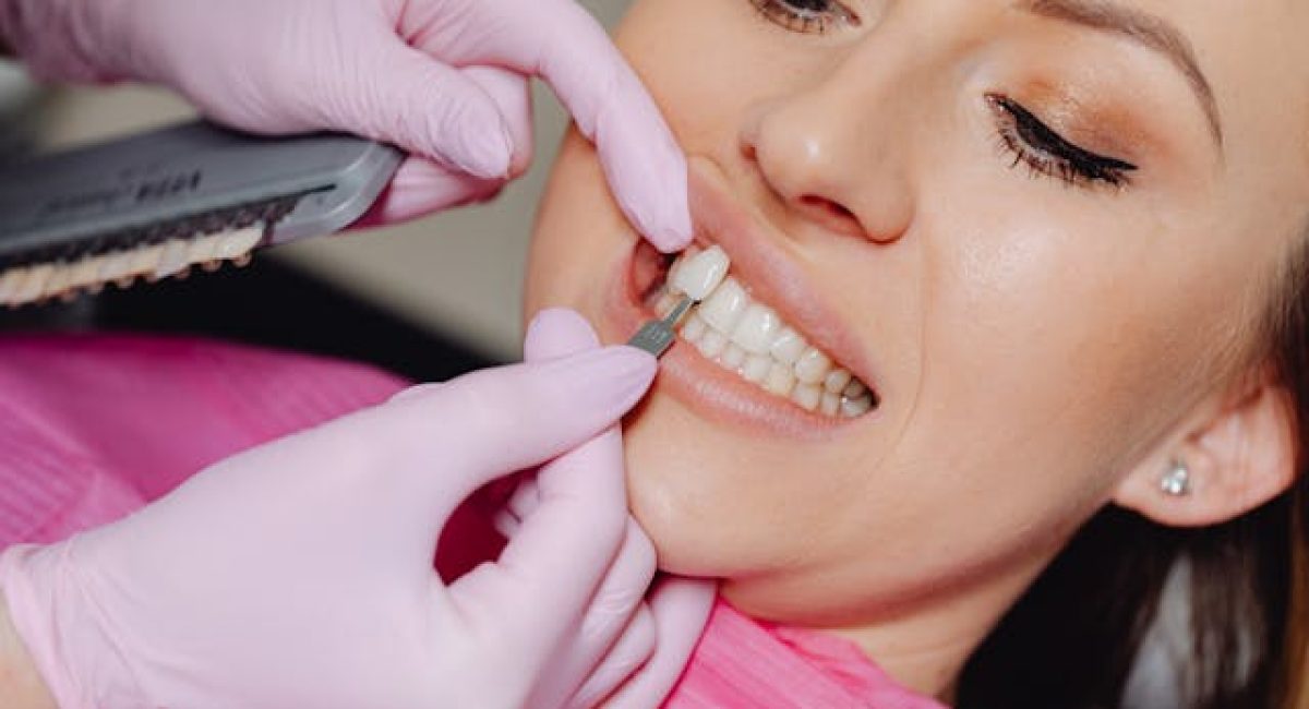 smile makeover